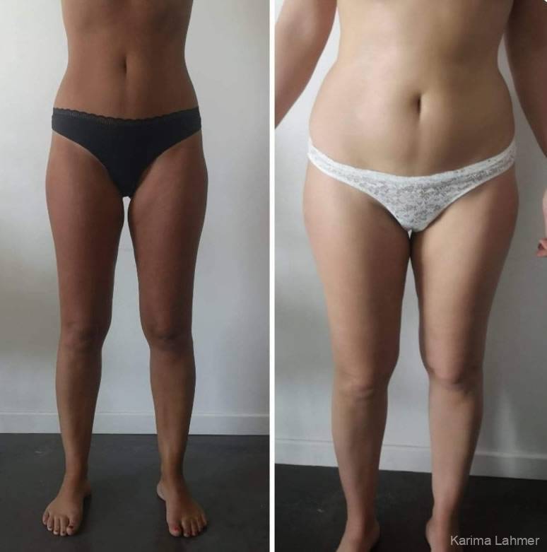 Massage Minceur/Anti-Cellulite